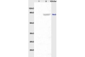 Lane 1: rat kidney lysates Lane 2: mouse intestine lysates probed with Anti P-cadherin Polyclonal Antibody, Unconjugated (ABIN738531) at 1:200 in 4 °C. (P-Cadherin anticorps  (AA 625-725))