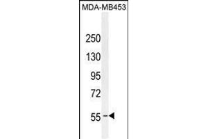 ESR1 antibody (ABIN659085 and ABIN2838074) western blot analysis in MDA-M cell line lysates (35 μg/lane). (Estrogen Receptor alpha anticorps)