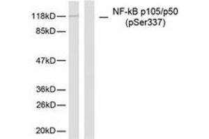 Western Blotting (WB) image for anti-Nuclear Factor of kappa Light Polypeptide Gene Enhancer in B-Cells 1 (NFKB1) (pSer337) antibody (ABIN2888484) (NFKB1 anticorps  (pSer337))