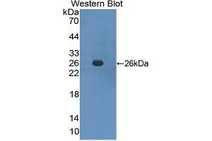 Western Blotting (WB) image for anti-Interferon alpha/beta Receptor 1 (IFNAR1) (AA 28-227) antibody (ABIN2118487) (IFNAR1 anticorps  (AA 28-227))