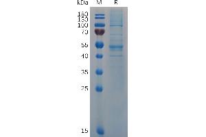 Human I Protein, hFc Tag on SDS-PAGE under reducing condition. (IFNB1 Protein (AA 22-187) (Fc Tag))