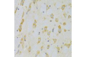 Immunohistochemistry of paraffin-embedded rat brain using CASP9 Antibody (ABIN5971434) at dilution of 1/100 (40x lens). (Caspase 9 anticorps)