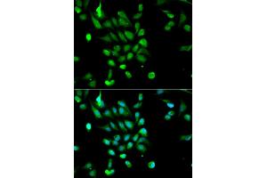 Immunofluorescence analysis of MCF-7 cells using PSMC5 antibody (ABIN5970727). (PSMC5 anticorps)