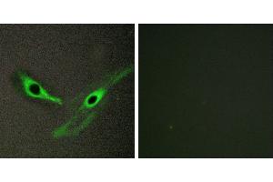 Peptide - +Immunohistochemistry analysis of paraffin-embedded human brain tissue, using ICK antibody. (ICK anticorps)