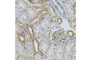Immunohistochemistry of paraffin-embedded rat kidney using HSP90AB1 Antibody (ABIN5970445) at dilution of 1/100 (40x lens). (HSP90AB1 anticorps)