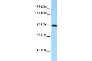 Western Blotting (WB) image for anti-IWS1 Homolog (IWS1) (N-Term) antibody (ABIN2790110) (IWS1 anticorps  (N-Term))