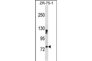 Western blot analysis in ZR-75-1 cell line lysates (35ug/lane). (KIF3A anticorps  (C-Term))