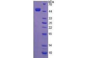 SDS-PAGE analysis of Horse Interferon beta Protein. (IFNB1 Protéine)