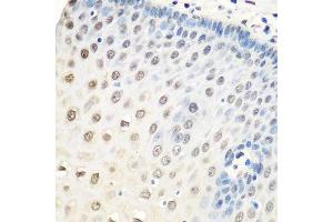 Immunohistochemistry of paraffin-embedded human esophagus using HNRNPA0 antibody. (HNRNPA0 anticorps  (AA 1-180))