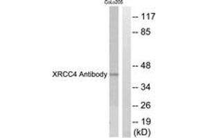 Western blot analysis of extracts from COLO205 cells, using XRCC4 Antibody. (DIRC2 anticorps  (AA 261-310))