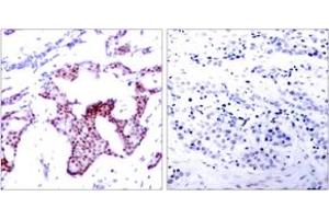 Immunohistochemistry (IHC) image for anti-Nuclear Factor-kB p65 (NFkBP65) (pSer276) antibody (ABIN2888487) (NF-kB p65 anticorps  (pSer276))