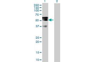 Western Blot analysis of LIPG expression in transfected 293T cell line by LIPG MaxPab polyclonal antibody. (LIPG anticorps  (AA 1-500))