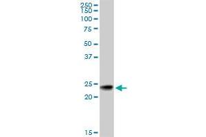 Western Blotting (WB) image for anti-RAB7B, Member RAS Oncogene Family (RAB7B) (AA 100-199) antibody (ABIN567027)