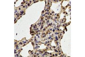 Immunohistochemical analysis of CDK6 staining in rat lung  formalin fixed paraffin embedded tissue section. (CDK6 anticorps)