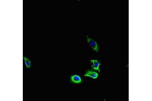 Immunofluorescent analysis of U251 cells using ABIN7163626 at dilution of 1:100 and Alexa Fluor 488-congugated AffiniPure Goat Anti-Rabbit IgG(H+L) (PDGFRA anticorps  (AA 30-198))