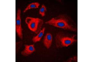 Immunofluorescent analysis of HSPH1 staining in HeLa cells. (HSPH1 anticorps  (C-Term))