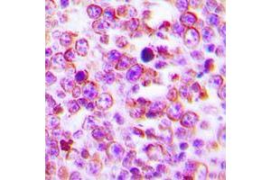 Immunohistochemical analysis of Claudin 2 staining in human tonsil formalin fixed paraffin embedded tissue section. (Claudin 2 anticorps  (C-Term))