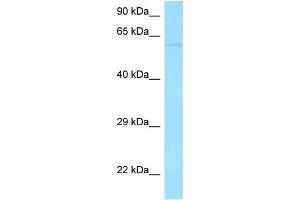 Western Blotting (WB) image for anti-Protein Phosphatase 2A 48 KDa Regulatory Subunit (PPP2R3B) (N-Term) antibody (ABIN2775378) (PPP2R3B anticorps  (N-Term))