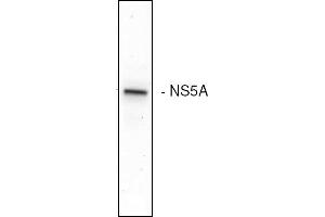 Western blot analysis of the HCV NS5A expression in Huh7 cells (Hepatitis C Virus anticorps)