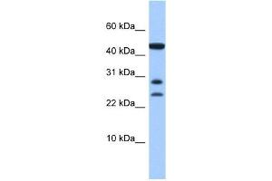 C20ORF141 antibody used at 1 ug/ml to detect target protein. (C20orf141 anticorps  (Middle Region))