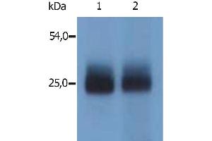 Western Blotting immunostaining with polyclonal anti-mouse NTAL antibody (specific for N-terminal domain of mouse NTAL) (LAT2 anticorps  (Cytoplasmic Domain))