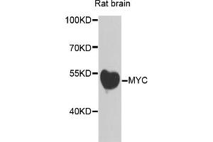 Western blot analysis of extracts of rat brain, using MYC antibody (ABIN5996012) at 1/500 dilution. (c-MYC anticorps)