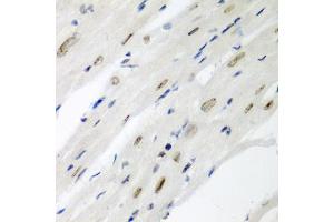 Immunohistochemistry of paraffin-embedded mouse heart using CDC27 antibody (ABIN5975347) at dilution of 1/200 (40x lens). (CDC27 anticorps)