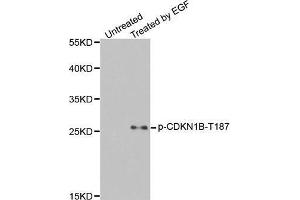 Western Blotting (WB) image for anti-Cyclin-Dependent Kinase Inhibitor 1B (p27, Kip1) (CDKN1B) (pThr187) antibody (ABIN3020148) (CDKN1B anticorps  (pThr187))