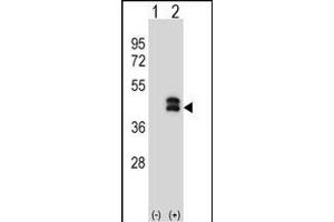Western blot analysis of DUSP6 (arrow) using rabbit polyclonal DUSP6 Antibody (N-term) (ABIN1539487 and ABIN2849153). (DUSP6 anticorps  (N-Term))