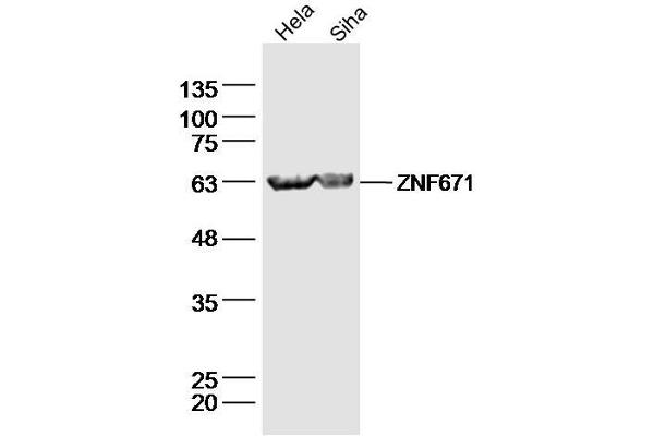 ZNF671 anticorps  (AA 101-200)