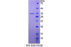 Image no. 1 for Kallikrein-Related Peptidase 13 (KLK13) (AA 22-277) protein (His tag) (ABIN6236981) (Kallikrein 13 Protein (AA 22-277) (His tag))