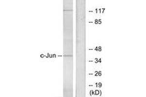 Western Blotting (WB) image for anti-Jun Proto-Oncogene (JUN) (AA 40-89) antibody (ABIN2888966) (C-JUN anticorps  (AA 40-89))
