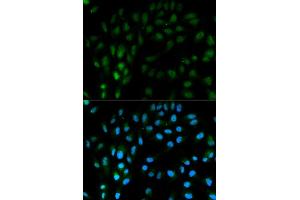 Immunofluorescence analysis of MCF7 cell using TFPI antibody. (TFPI anticorps)