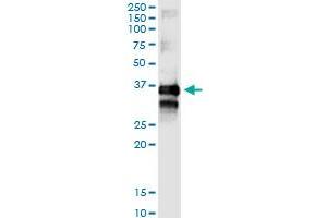 Immunoprecipitation of TTC1 transfected lysate using rabbit polyclonal anti-TTC1 and Protein A Magnetic Bead (TTC1 (Humain) IP-WB Antibody Pair)