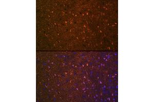 Immunofluorescence analysis of mouse brain using BDNF Rabbit mAb (ABIN7265916) at dilution of 1:100 (40x lens). (BDNF anticorps)