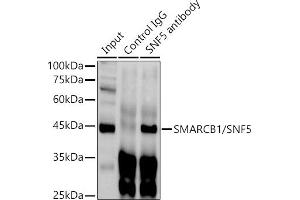 Immunoprecipitation analysis of 300 μg extracts of HeLa cells using 3 μg SM/SNF5 antibody . (SMARCB1 anticorps  (AA 77-376))