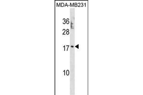 PTRH2 anticorps  (N-Term)