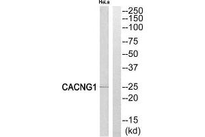 Western Blotting (WB) image for anti-Calcium Channel, Voltage-Dependent, gamma Subunit 1 (CACNG1) (Internal Region) antibody (ABIN1852387) (CACNG1 anticorps  (Internal Region))