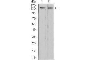 Western blot analysis using RAD50 mouse mAb against C6 (1) and HepG2 (2) cell lysate. (RAD50 anticorps  (AA 228-359))