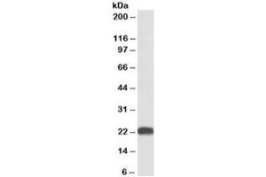 Western blot testing of human liver lysate with BLVRB antibody at 0. (BLVRB anticorps)
