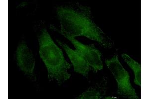 Immunofluorescence of monoclonal antibody to TRAPPC4 on HeLa cell. (TRAPPC4 anticorps  (AA 1-219))