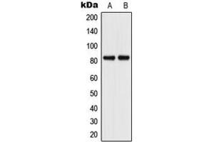 Western blot analysis of CD106 expression in A549 (A), HuvEc (B) whole cell lysates. (VCAM1 anticorps  (Center))