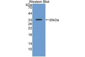 Western blot analysis of the recombinant protein. (SLC9A3R2 anticorps  (AA 56-337))