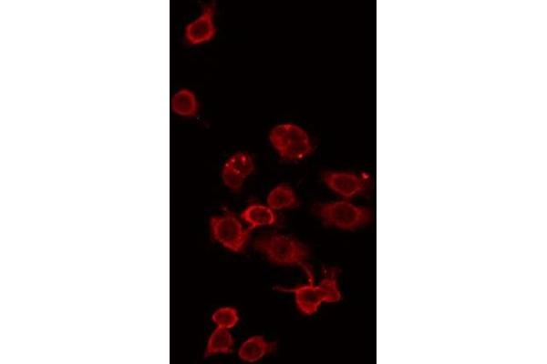 ZDHHC15 anticorps  (C-Term)