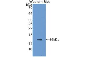 Western blot analysis of the recombinant protein. (FABP5 anticorps)