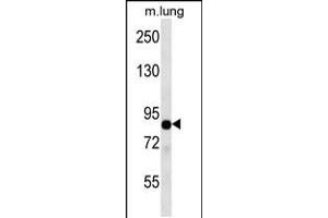 Western blot analysis in mouse lung tissue lysates (35ug/lane). (TLE2 anticorps  (C-Term))