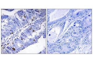 Immunohistochemistry (IHC) image for anti-Nuclear Receptor Subfamily 4, Group A, Member 1 (NR4A1) (pSer351) antibody (ABIN1847422) (NR4A1 anticorps  (pSer351))