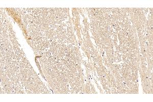 Detection of CPLX1 in Human Cerebrum Tissue using Polyclonal Antibody to Complexin 1 (CPLX1) (Complexin 1 anticorps  (AA 1-134))