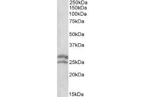 Western Blotting (WB) image for B-Cell CLL/lymphoma 2 (BCL2) peptide (ABIN368747) (B-Cell CLL/lymphoma 2 (BCL2) Peptide)