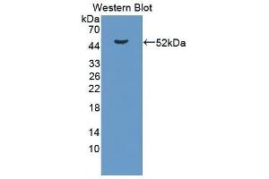 Western Blotting (WB) image for anti-Lipopolysaccharide Binding Protein (LBP) antibody (Biotin) (ABIN1174580) (LBP anticorps  (Biotin))